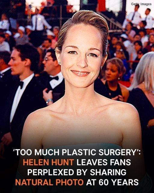 The 60-year-old actress faced significant backlash over her natural appearance.